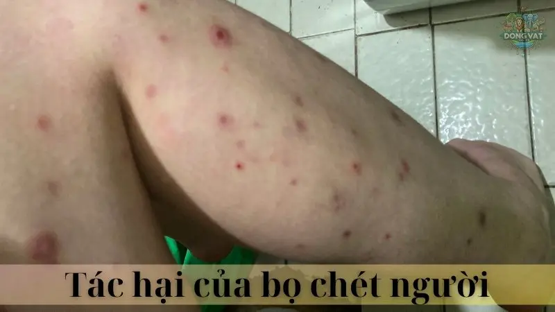 Bọ chét người 03