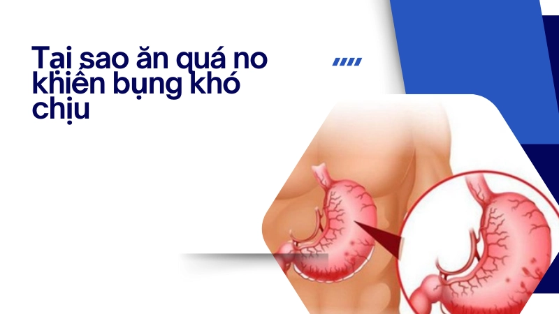 Mô phỏng dạ dày bị giãn nở quá mức khi ăn no