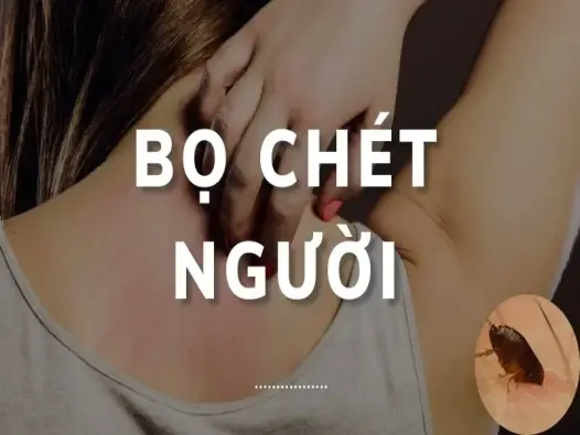 Hé lộ cách diệt bọ chét người nhanh chóng, hiệu quả, an toàn