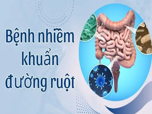 Bệnh nhiễm khuẩn đường ruột - Dấu hiệu lạ khiến lo ngại