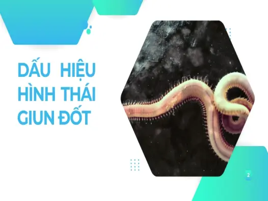 Kiến thức cơ bản về giun đốt nhiều người hiểu sai bạn nên biết