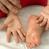 Bệnh chân tay miệng ở trẻ: Nhận biết, phòng ngừa và điều trị hiệu quả