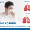 Bệnh lao phổi có chữa được không? Phác đồ điều trị và tiên lượng