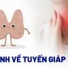 Bệnh tuyến giáp: Hiểu rõ triệu chứng, nguy hiểm và cách điều trị