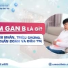 Bệnh Viêm Gan B: Nguyên Nhân, Dấu Hiệu và Cách Phòng Ngừa Hiệu Quả