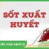 Biểu hiện bệnh sốt xuất huyết: Nhận biết sớm, phòng ngừa hiệu quả