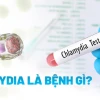Chlamydia là bệnh gì? Triệu chứng, nguyên nhân và cách điều trị