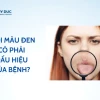 Lưỡi Bị Đen Là Bệnh Gì? Nguyên Nhân Và Cách Xử Lý Hiệu Quả