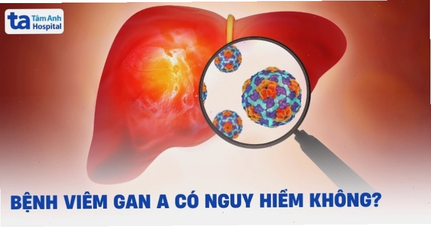 Biểu đồ so sánh mức độ nguy hiểm của viêm gan A so với các bệnh gan khác