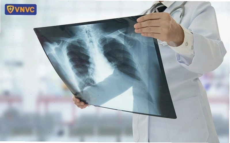 Các biến chứng nguy hiểm có thể gặp phải khi mắc bệnh zona
