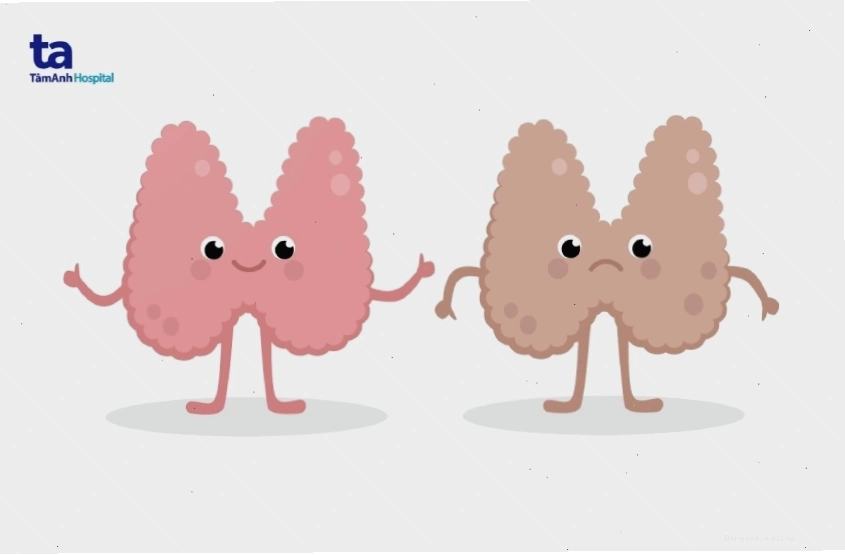 Cường giáp và suy giáp là hai nguyên nhân phổ biến của bệnh tuyến giáp