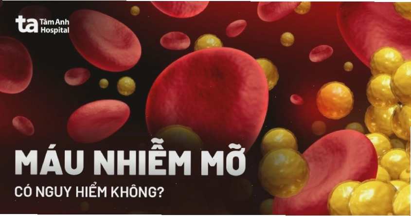 Người bệnh có biểu hiện đau tức ngực do máu nhiễm mỡ