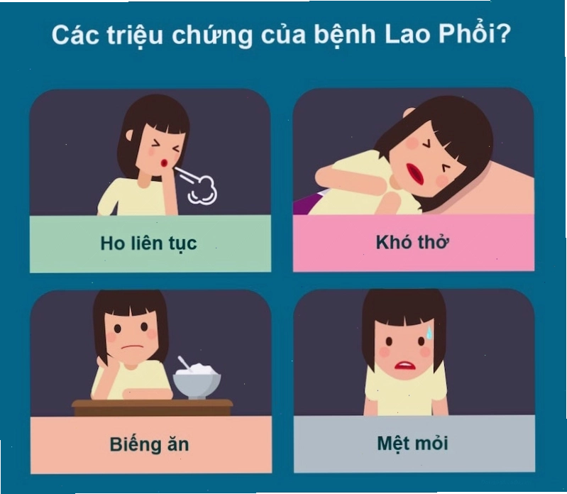 Những triệu chứng lao phổi điển hình