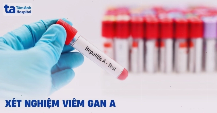 Ống nghiệm máu và thiết bị xét nghiệm dùng để chẩn đoán viêm gan A