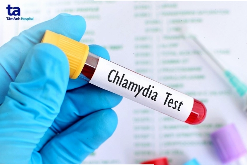 Phương pháp điều trị bệnh chlamydia