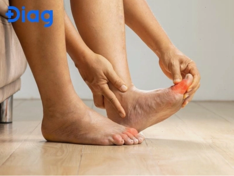 Siêu âm và CT năng lượng kép giúp phát hiện sớm tinh thể urat trong khớp