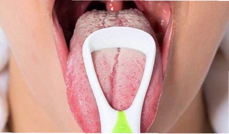 Thay đổi chế độ ăn uống, hạn chế thực phẩm có màu đậm để cải thiện lưỡi bị đen