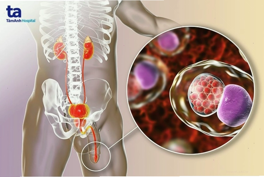 Tỷ lệ phổ biến của bệnh chlamydia