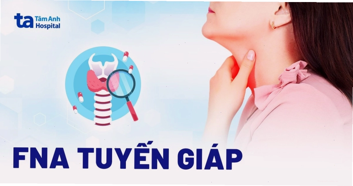 Xét nghiệm FNA tuyến giáp