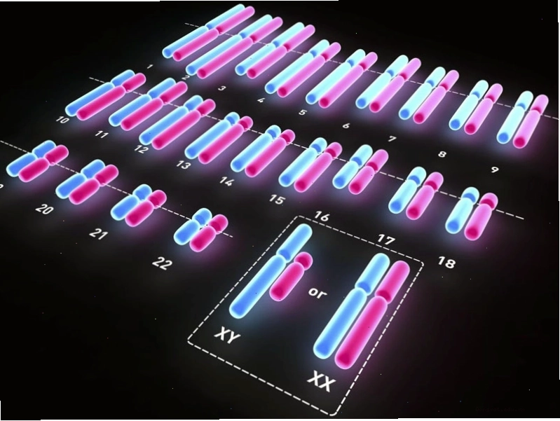 Xét nghiệm Karyotype để chẩn đoán chính xác hội chứng Turner