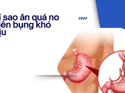 Hậu quả của việc ăn quá no và cách bảo vệ hệ tiêu hóa hiệu quả