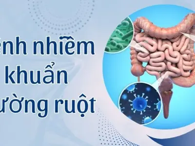 Bệnh nhiễm khuẩn đường ruột - Dấu hiệu lạ khiến lo ngại