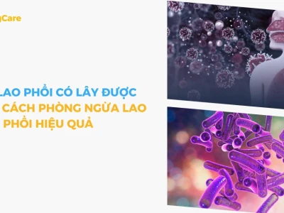 Bệnh lao phổi có lây sang người không và cách phòng tránh