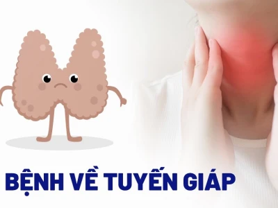 Bệnh tuyến giáp: Hiểu rõ triệu chứng, nguy hiểm và cách điều trị