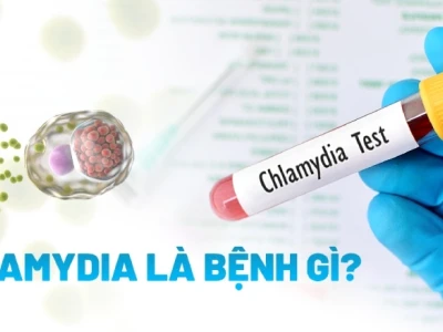 Chlamydia là bệnh gì? Triệu chứng, nguyên nhân và cách điều trị