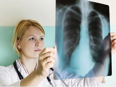 Triệu chứng bệnh lao phổi: Nhận biết sớm và biện pháp phòng ngừa
