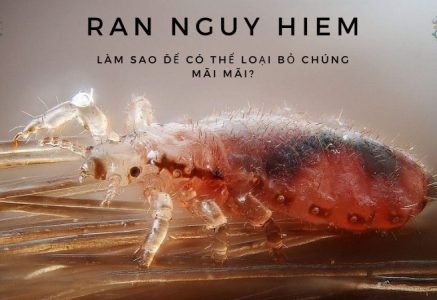 Rận nguy hiểm: Làm sao để có thể loại bỏ chúng mãi mãi?